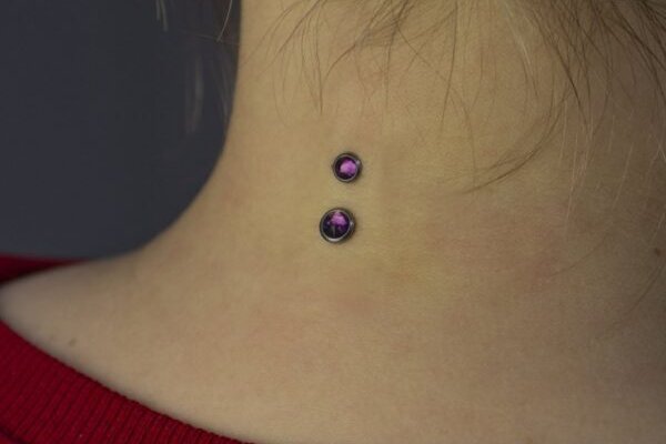 mikrodermal-8-e1630478235880